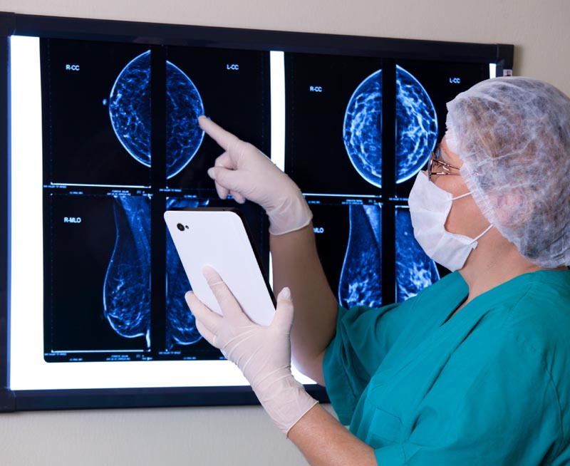 Digital  Mammography